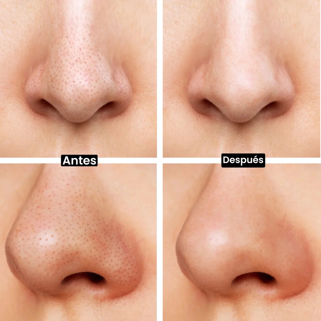 Kit Profesional para una Piel Impecable